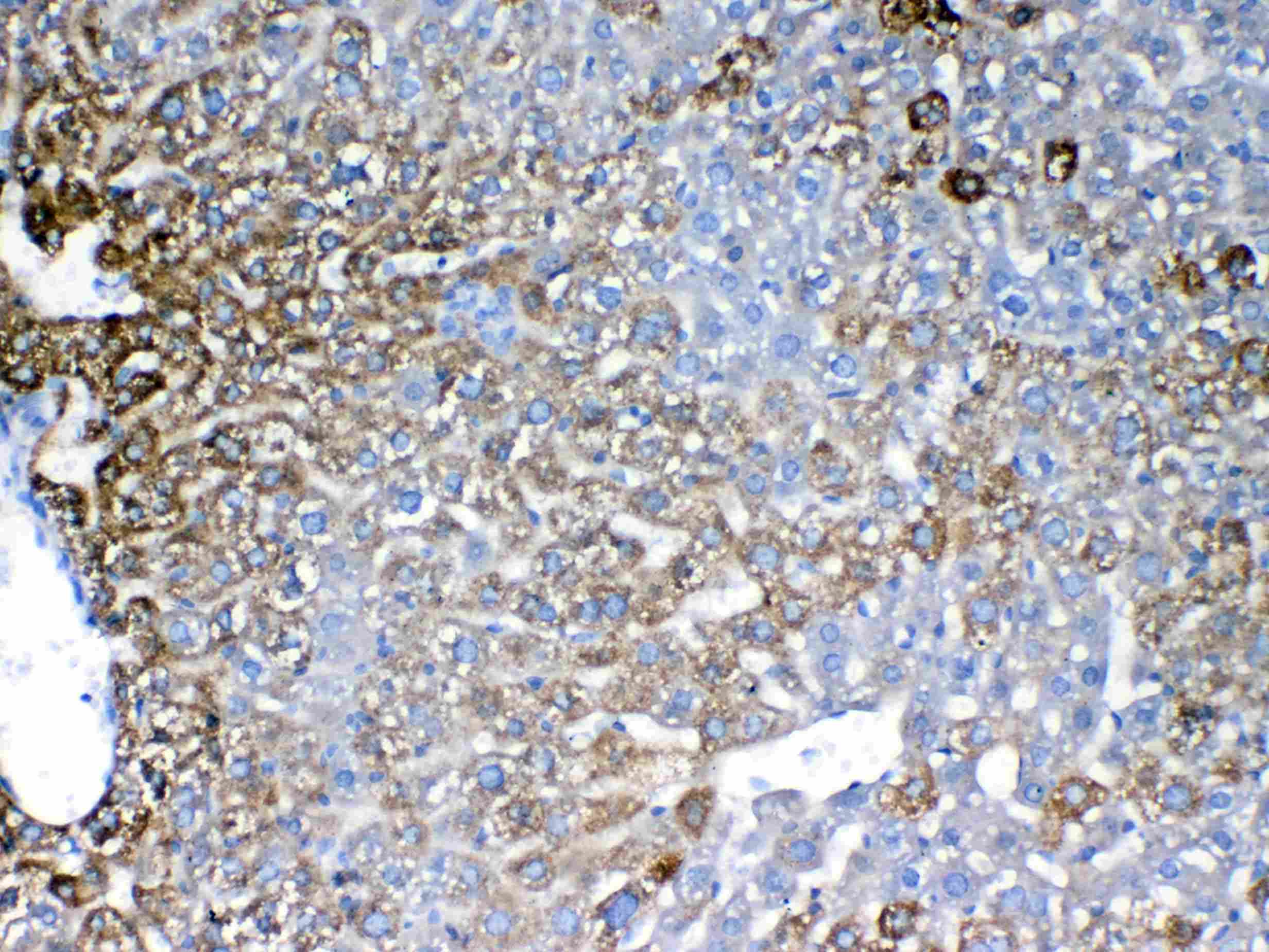 IGFBP1 Antibody