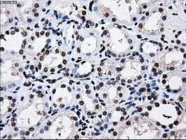 RPA2 / RFA2 / RPA34 Antibody (clone OTI7C12)
