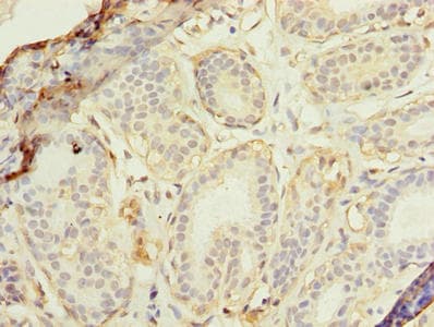RAD23B / HR23B Antibody