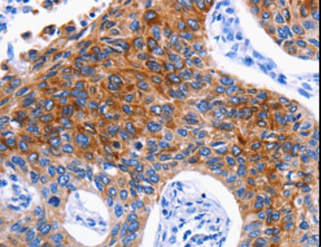 Polyclonal Rabbit anti-Human DRD4 / Dopamine Receptor D4 Antibody (IHC, WB)