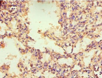 NR2C1 Antibody (aa1-240)