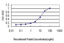 Monoclonal Mouse anti-Human Dystonin / BPAG1 Antibody (clone 1B10, IF, WB)
