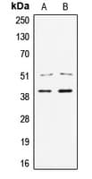 Polyclonal Rabbit anti-Human TCF7 Antibody (N-Terminus, IHC, WB)