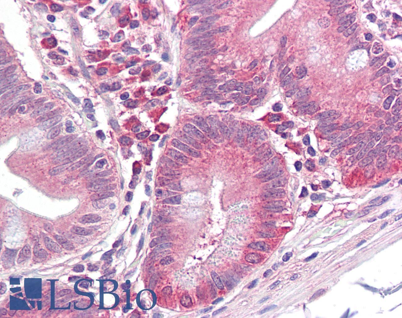 IHC-plus™ Monoclonal Mouse anti-Human EIF2S1 Antibody (clone AT5E10, IHC, WB)