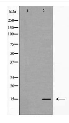 CDKN2B / p15 INK4b Antibody