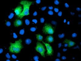 IHC-plus™ PGAM2 Antibody (clone 4E9)