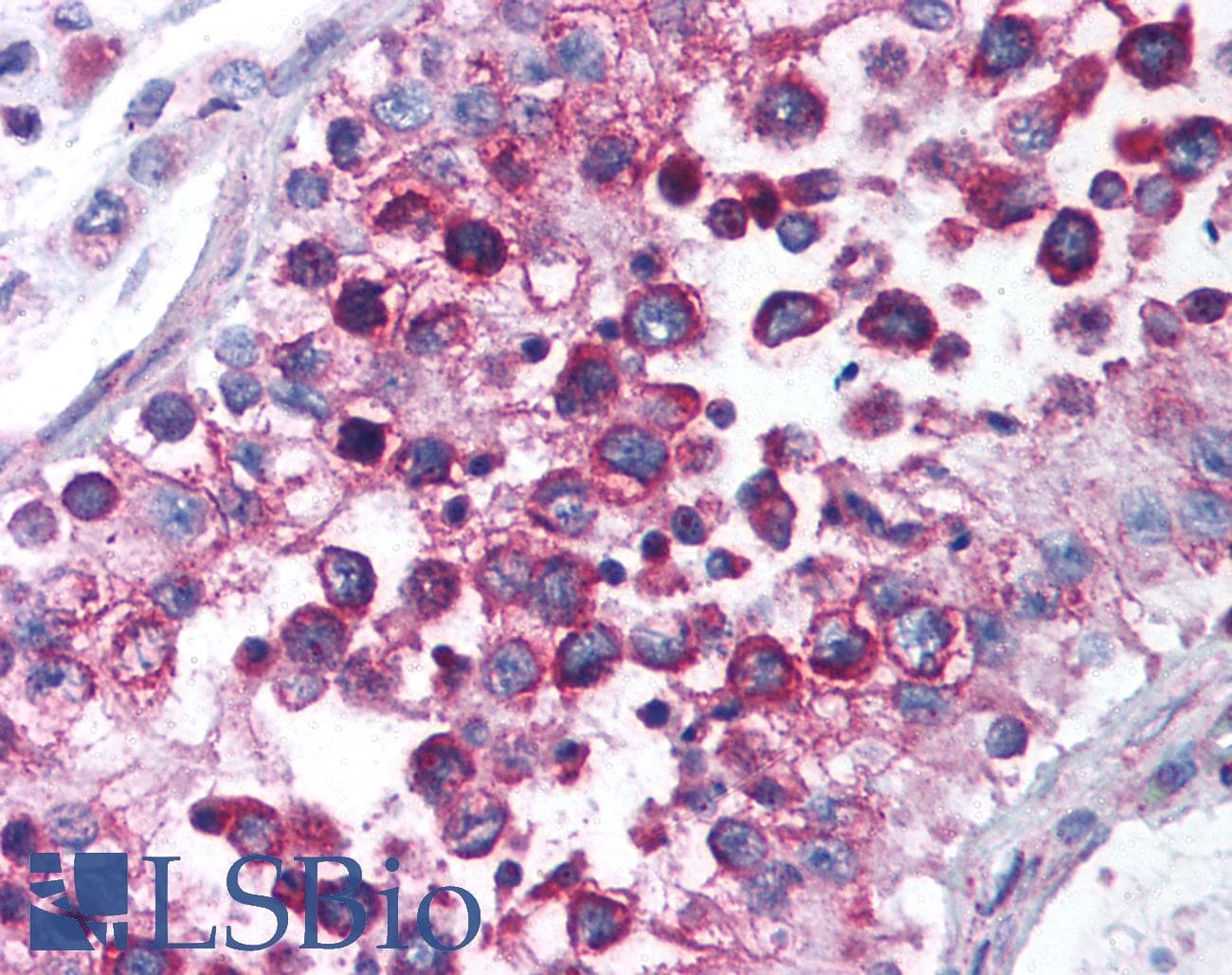 IHC-plus™ NPAS3 Antibody