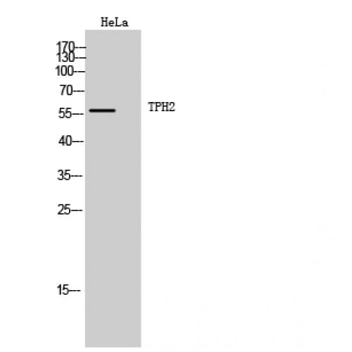 TPH2 Antibody (1-80 aa)
