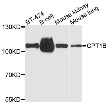 CPT1B Antibody