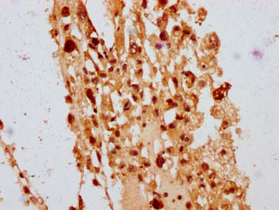 POLE4 / p12 Antibody