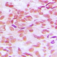 GSK3 Alpha+Beta Antibody (Internal)