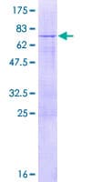 Human TBC1D20 Protein (Recombinant GST)
