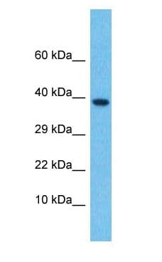 TGFB4 / LEFTY2 Antibody (N-Terminus)