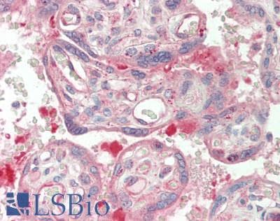 IHC-plus™ Polyclonal Rabbit anti-Human PDCD6IP / ALIX Antibody (aa818-868, IHC, WB)