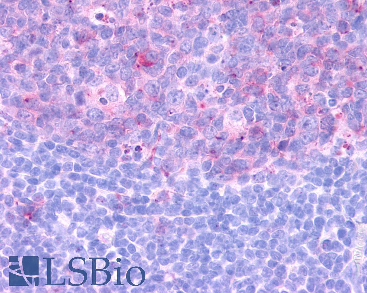 PathPlus™ CCR3 Antibody (Extracellular Domain)