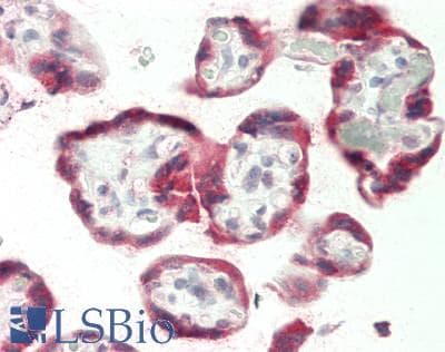 IHC-plus™ Polyclonal Rabbit anti-Human ANKRD44 Antibody (aa37-262, IHC, WB)