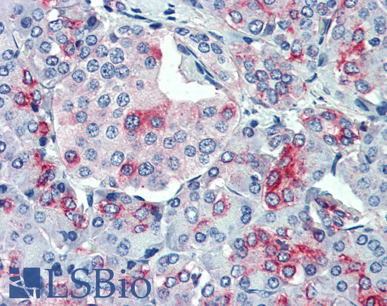 IHC-plus™ SLC11A2 / DMT1 Antibody (Internal)