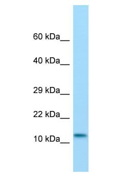 MKL2 Antibody (aa87-136)