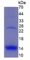 Human CCL3 / MIP-1-Alpha Protein (Recombinant His, N-Terminal)