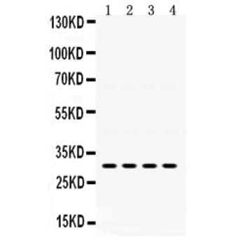 IGFBP3 Antibody (aa214-252)