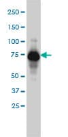 ADD1 / Adducin Alpha Antibody (clone 2C9)