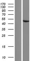 ACTBL2 Protein (Over-Expression Lysate Myc-DDK (Flag))