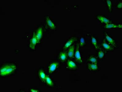 IHC-plus™ PP2CB / PPP2CB Antibody