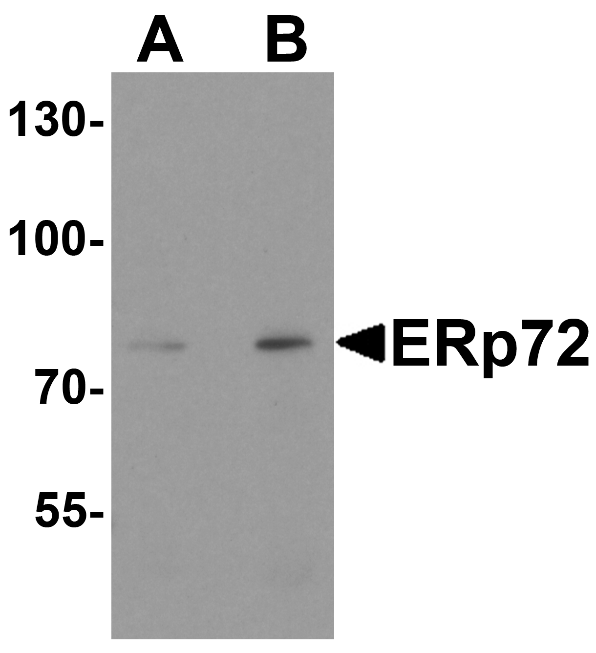 PDIA4 / ERP72 Antibody