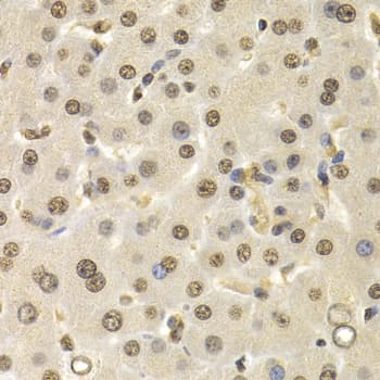 Cullin 4B / CUL4B Antibody