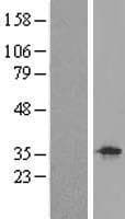 GTF2E2 Protein (Over-Expression Lysate Myc-DDK (Flag))
