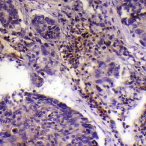 Polyclonal Rabbit anti-Human COL17A1 / Collagen XVII Antibody (1-80 aa, N-terminal, IHC)