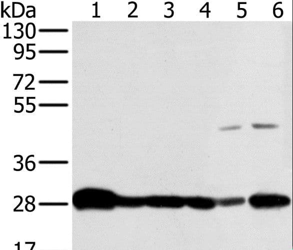 Polyclonal Rabbit anti-Human NDUFS3 Antibody (IHC, WB)