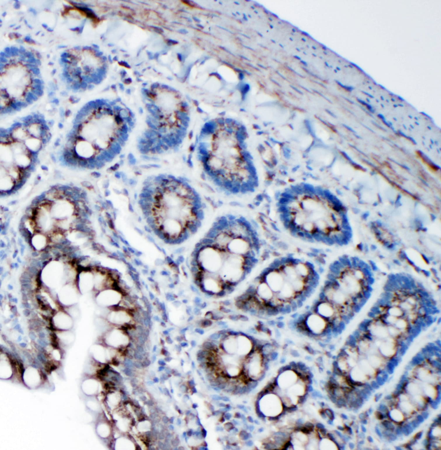 Polyclonal Rabbit anti-Human SSR3 / TRAP-Gamma Antibody (aa8-23, IHC, WB)