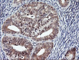 Monoclonal Mouse anti-Human USP10 Antibody (clone OTI1A10, IHC, WB)