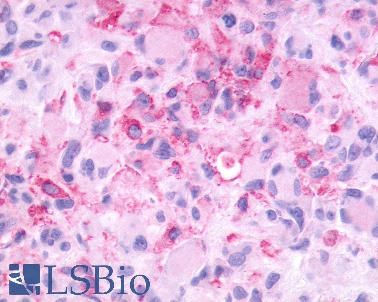 PathPlus™ GRM3 / MGLUR3 Antibody (N-Terminus)
