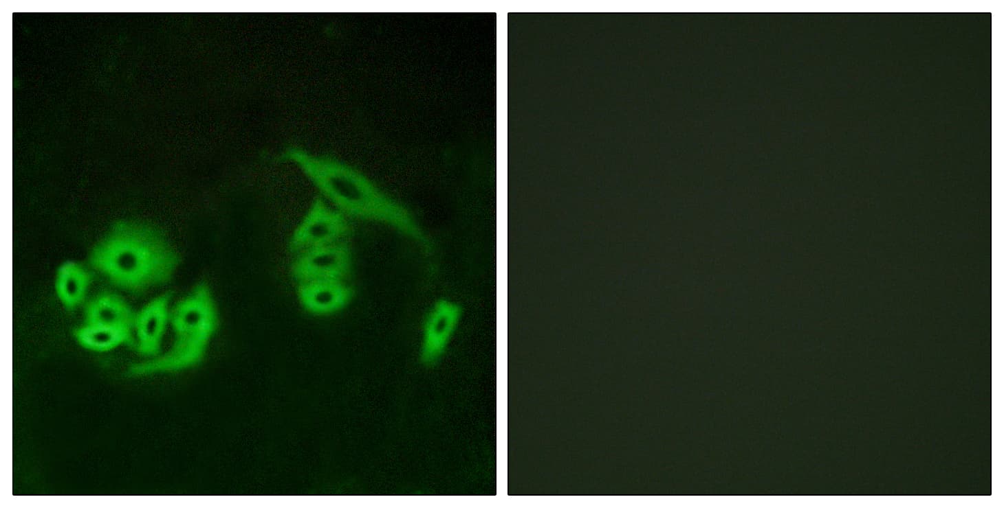 GPR12 Antibody (aa1-50)