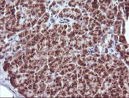 CTAG1B / NY-ESO-1 Antibody (clone OTI5A5)