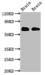 Polyclonal Rabbit anti-Human SLC1A2 / EAAT2 / GLT-1 Antibody (aa460-574, IHC, IF, WB)