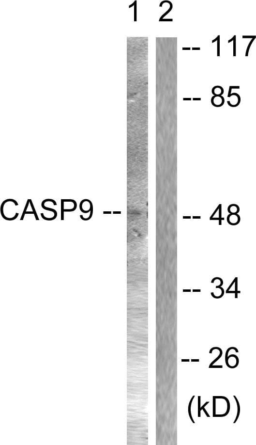 Polyclonal Rabbit anti-Human CASP9 / Caspase 9 Antibody (p125, IHC, IF, WB)