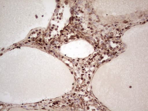 NR3C1/Glucocorticoid Receptor Antibody (aa1-265, clone OTI2C4)