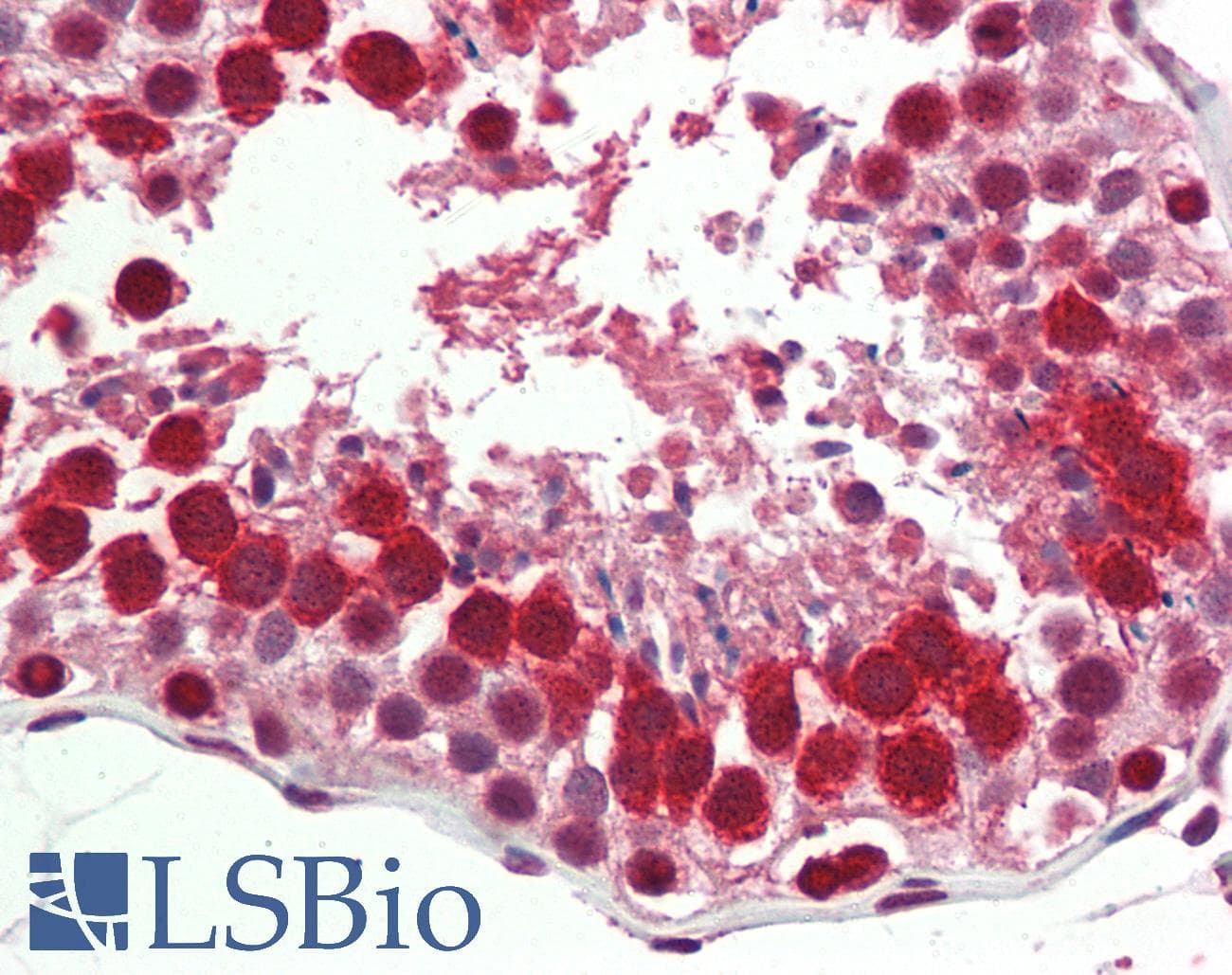 IHC-plus™ RTCB / C22orf28 Antibody (aa201-214)