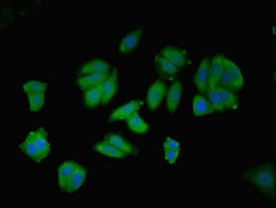 AGT / Angiotensinogen Antibody (aa35-285)