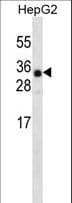 ANKRD46 Antibody (aa17-46)