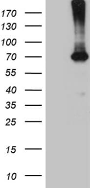 Monoclonal Mouse anti-Human PGM2L1 Antibody (clone OTI2D12, WB)