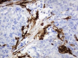 TP / Thymidine Phosphorylase Antibody (aa311-482, clone 7A6, Carrier-free)