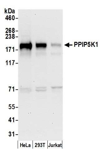HISPPD2A / VIP1 Antibody (aa1383-1433)