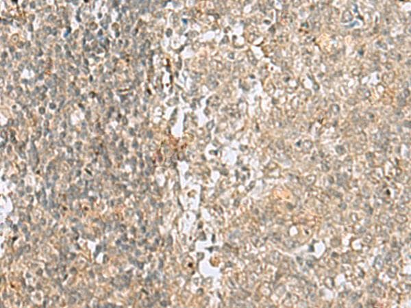 Polyclonal Rabbit anti-Human HMG20A Antibody (IHC)