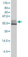 Monoclonal Mouse anti-Human EIF2S1 Antibody (clone 3H12-C11, IF, WB)