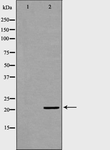 Polyclonal Rabbit anti-Human KRAS Antibody (aa159-184, IHC, WB)