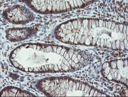 PROSC Antibody (clone OTI1G2)